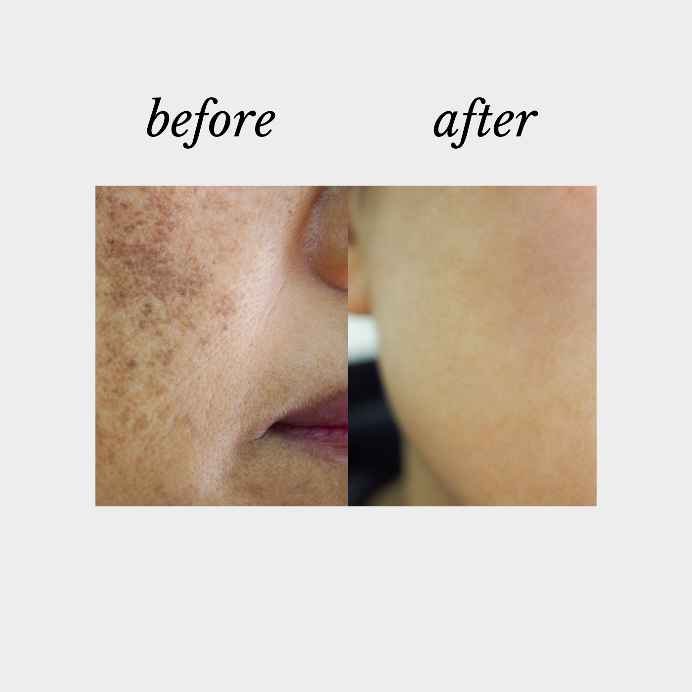 Serum |Defy Cosmeceuticals, Beauty on Rose, Essendon, Melbourne, Australia