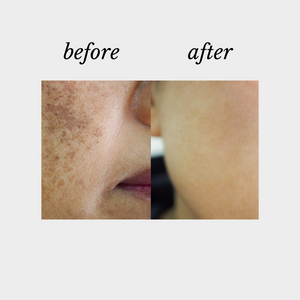 DNA Repair Complex, Defy Cosmeceuticals, Beauty on Rose, Essendon, Melbourne, Australia