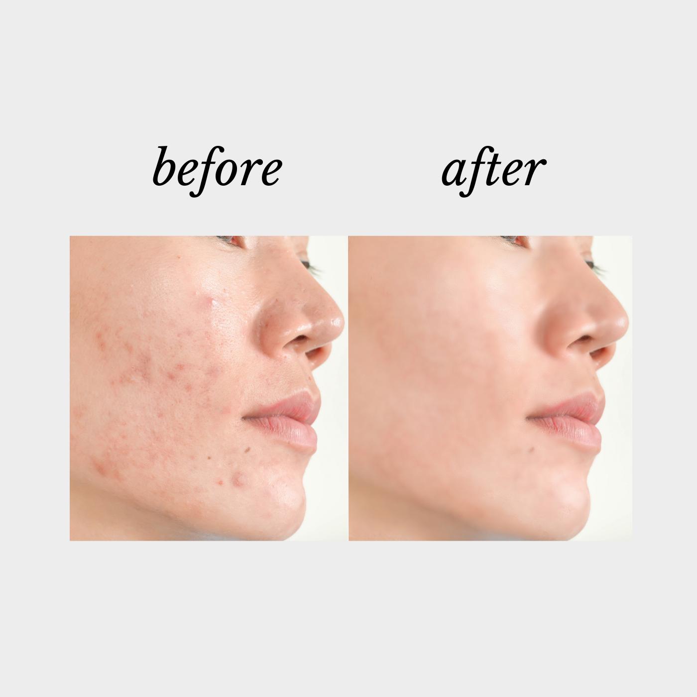 Repair Complex |Defy Cosmeceuticals, Beauty on Rose, Essendon, Melbourne, Australia