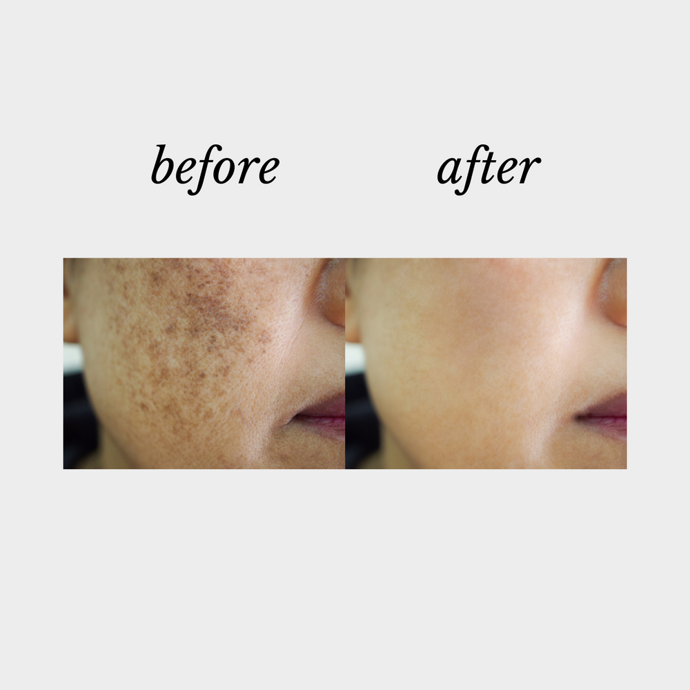 Vitality |Defy Cosmeceuticals, Beauty on Rose, Essendon, Melbourne, Australia
