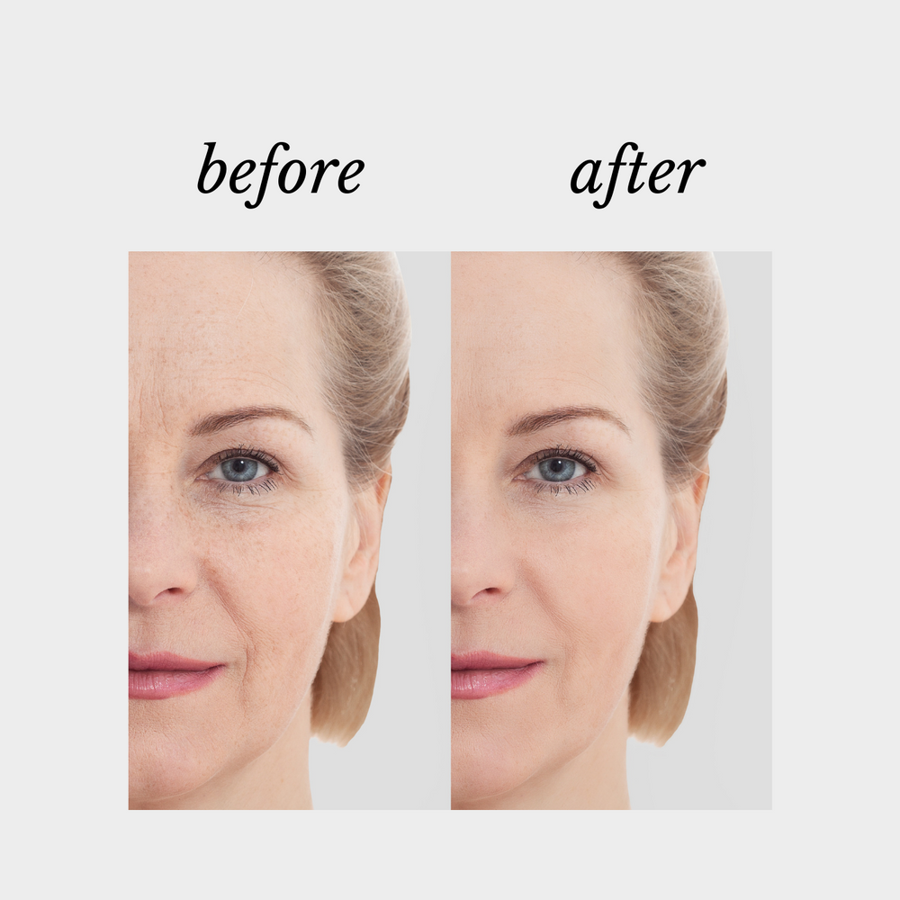iSynergy Defy Cosmeceuticals 10ml