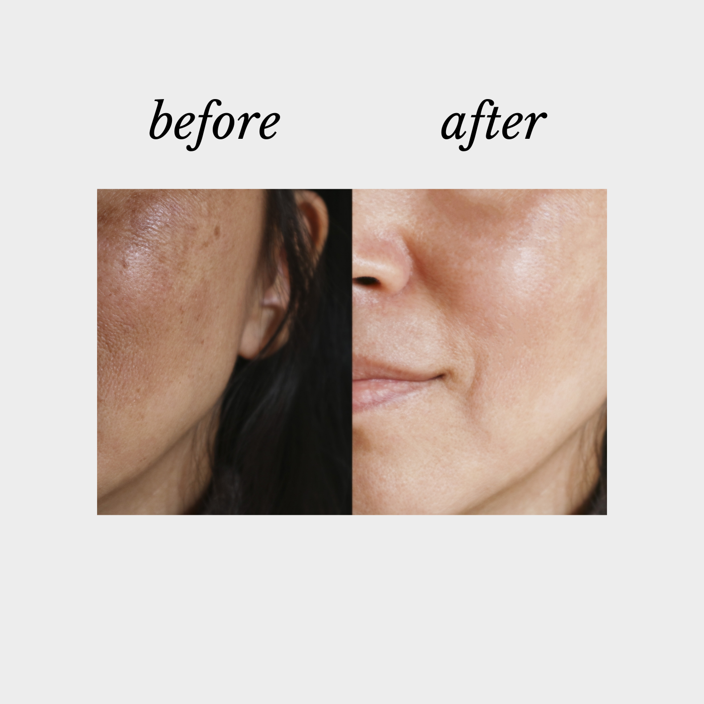 Pigment-Protect-Defy-Cosmeceuticals-Beauty-on-Rose-Essendon-Melbourne