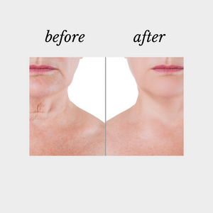Collagen Neck Repair | Defy Cosmeceuticals, Beauty on Rose, Essendon, Melbourne, Australia