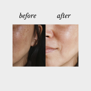 Vitality |Defy Cosmeceuticals, Beauty on Rose, Essendon, Melbourne, Australia